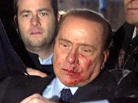 Berlusconi verwond