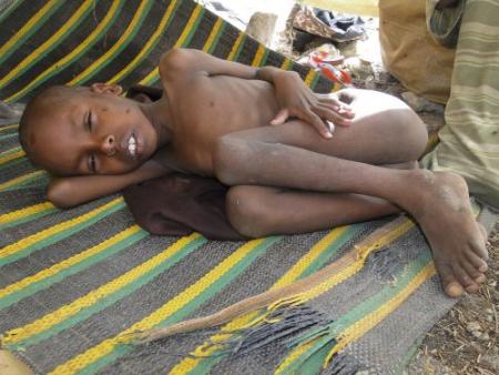 Situatie Somalië krijgt status hongersnood