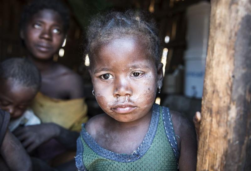 Honger op Madagaskar