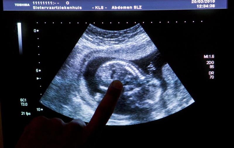 'Echo na dertien weken voor zwangere vrouw'