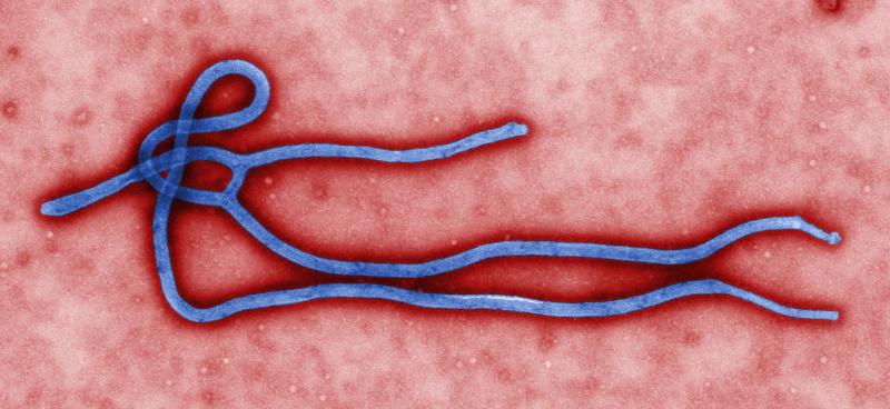 Ebolavirus (@WikimediaCommons) Ebolavirus (@WikimediaCommons)