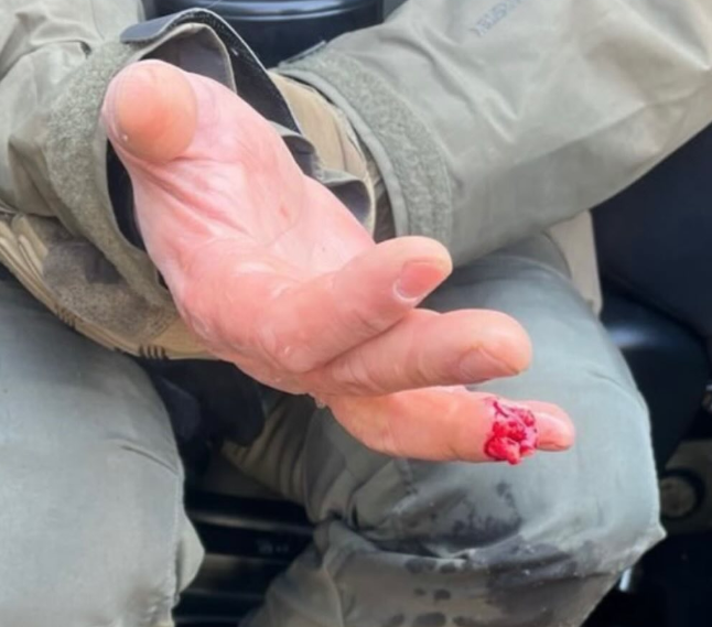 De hand van de HSI agent