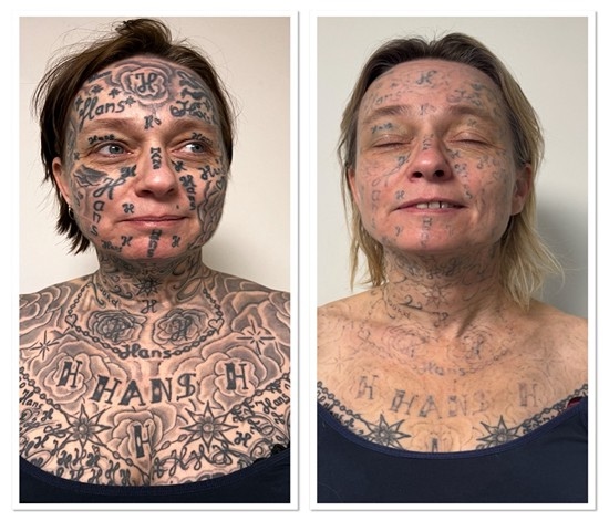 Joke werd onder dwang 250 x getatoeerd door haar partner Hans met zijn naam (@Spijtvantattoo)