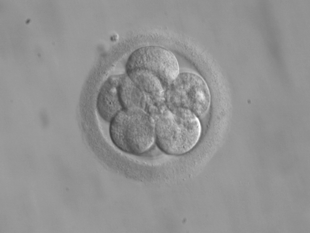 8-cell human embryo, day 3 (@ekem, Courtesy: RWJMS IVF Program) 8-cell human embryo, day 3 (@ekem, Courtesy: RWJMS IVF Program)